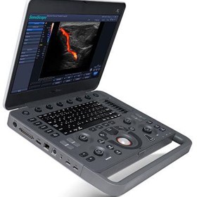 X3V Laptop Veterinary Colour Doppler Ultrasound Machine