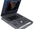 SonoScape - X3V Laptop Veterinary Colour Doppler Ultrasound Machine