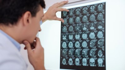 AAMRI welcomes $100 million boost to fight brain cancer