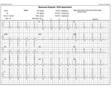 Beneware - Cardioshield CS180 & CS280 PC Based ECG