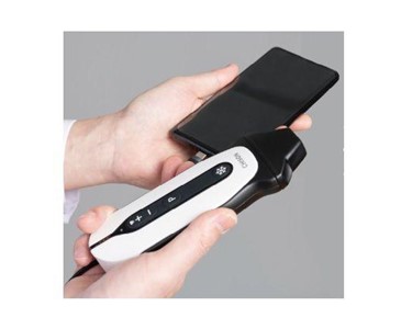 Chison - SonoEye Handheld Ultrasound | USB Probe Ultrasound Machine