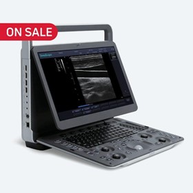 SonoScape E1 Ultrasound Machine WITH PROBE INCLUDED – ON SALE