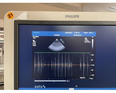 Philips - Ultrasound Machine | iE33 Cart G.1 xMatrix 