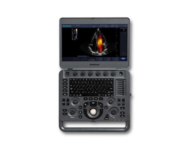 SonoScape - X5 Colour Doppler Portable Ultrasound Machine