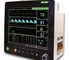 Multi-Parameter Veterinary Monitor | PM6000V