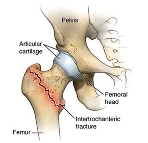 Falls & Fall Prevention Falls & Fall Prevention