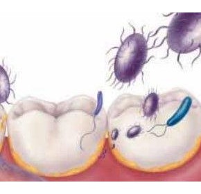 What dentists should know about nursing's dirty secret and oral care What dentists should know about nursing's dirty secret and oral care