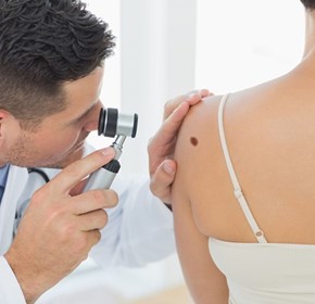 Why some moles become melanoma still a mystery Why some moles become melanoma still a mystery