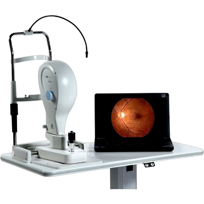 Retinal Camera