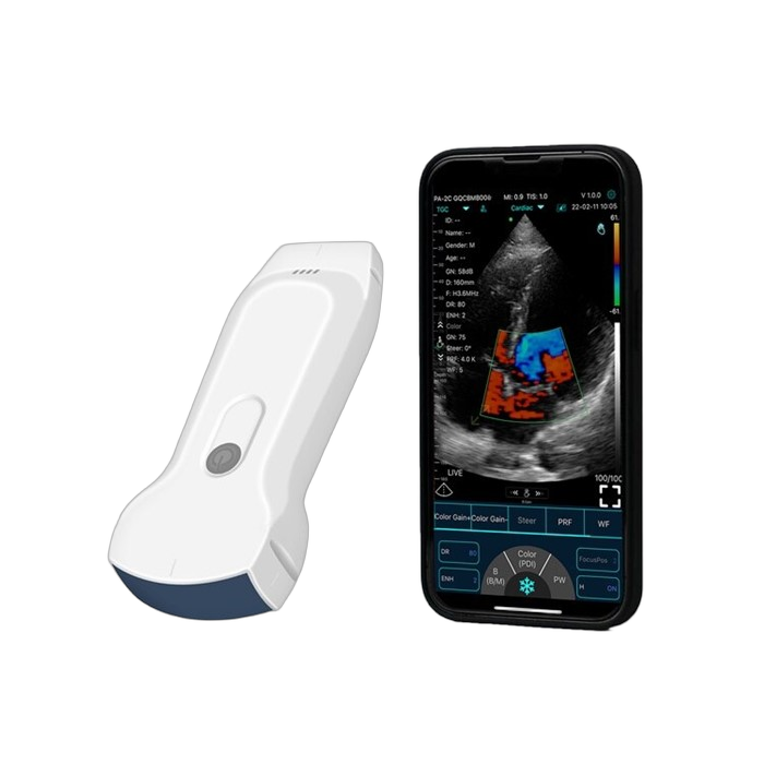 Handheld Ultrasound Machine