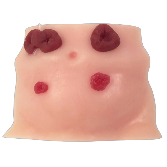 Ostomy Care Products
