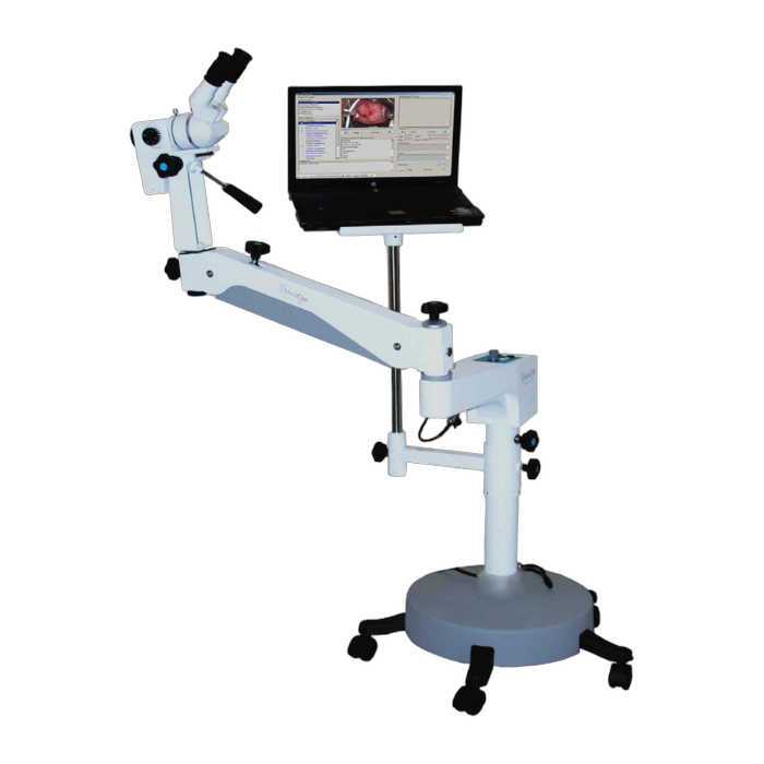 Gynaecology Colposcope