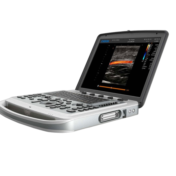 Portable Ultrasound Machine