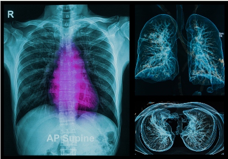 The team developed a portable, radiation-free and non-toxic device to replace the current invasive procedure.