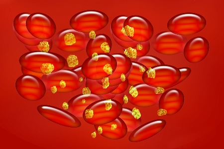 Disturbingly, only one in ten of the 5.6 million Australians with high blood cholesterol know they have it.