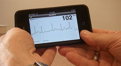 "The iECG allows us to screen patients for atrial fibrillation in minutes, and treat people early."