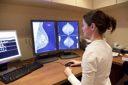 Breast cancer is a biologically complex disease and each tumour can have very different properties, so the more information that doctors have about each patient's cancer, the better they can plan treatments.