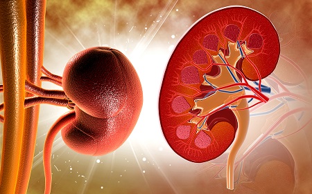 "(The researchers' work) is an important milestone in developing improved treatments for chronic kidney disease."