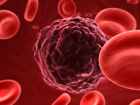 "(Survival protein) MCL-1 is found at high levels in a number of blood cancers and also many solid tumours, so there has been a strong drive to develop potential anti-cancer compounds that target MCL-1."
