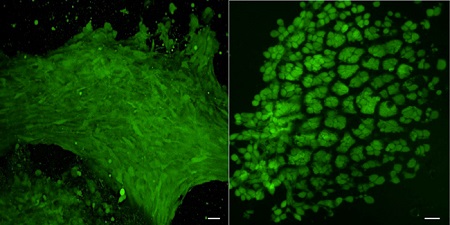 As the swollen gel compresses the cells trapped inside it, tooth-precursor cells (green) shrink, round up, become denser, and begin to deposit the minerals that harden teeth. (Images: Basma Hashmi, Harvard SEAS)