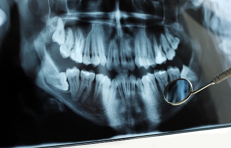 "Present day techniques in dental radiography are based on protocols and equipment developed prior to the Second World War."