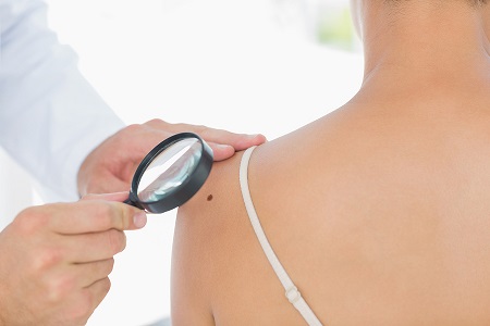 Scientists hope ground-breaking technology will facilitate in the early detection of skin cancer.