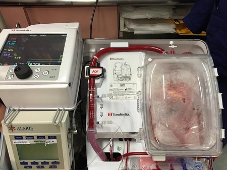 In a world first last year, Australian surgeons successfully resuscitated two hearts donated after circulatory death.