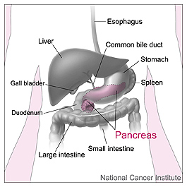 "Our results support an increased risk of pancreatic cancer associated with higher levels of cadmium, arsenic, and lead, as well as an inverse association with higher levels of selenium and nickel."