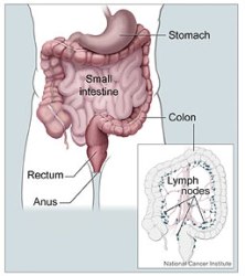 Researchers found that the levels of PGE2 correlate with levels of two methyltransferases, DNMT1 and DNMT3, in human colorectal cancer specimens.