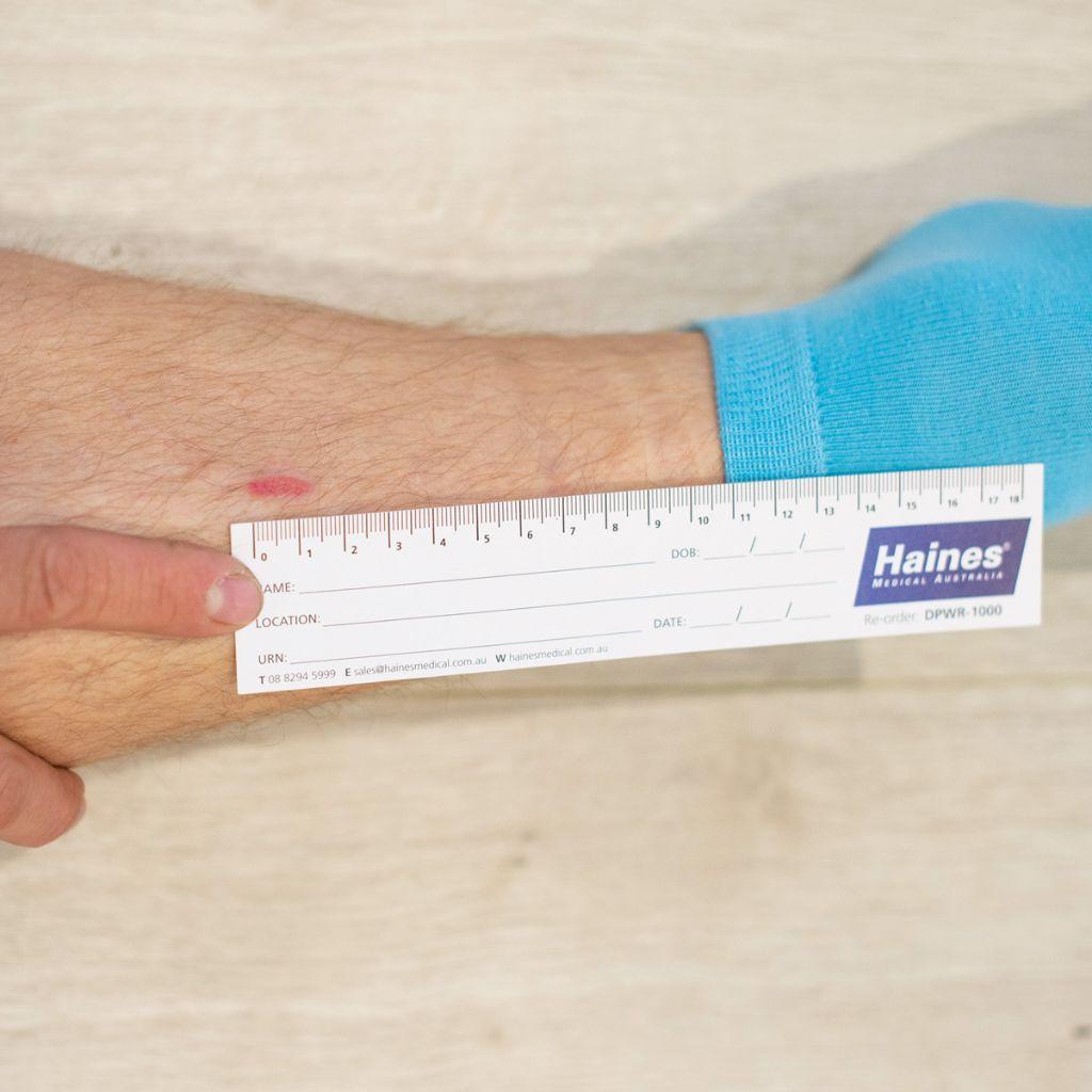 Disposable Wound Measuring Ruler Premium Paper Tape Measure