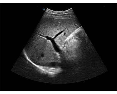 SonoScape - E1 B/W Portable Ultrasound