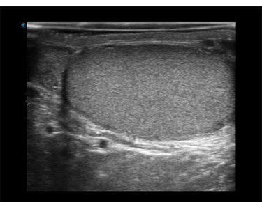 SonoScape - E3 Portable Color Doppler Ultrasound System