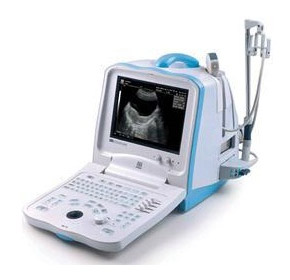 Digital Ultrasound Imaging System | DP-30