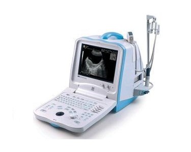 Mindray - Digital Ultrasound Imaging System | DP-30