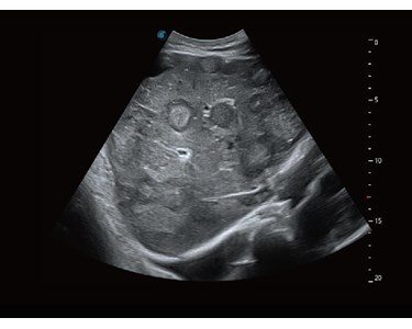 SonoScape - S60 Trolley Color Doppler Ultrasound System