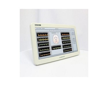 Medtech Edge - Dopplers | Dolphin 4D