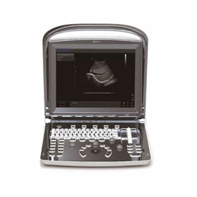 Ultrasound Machine | Eco 1