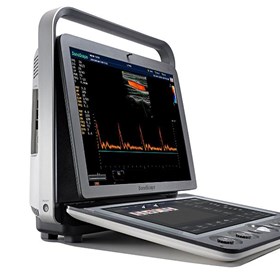 S9 Portable Color Doppler Ultrasound System