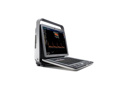 SonoScape - S9 Portable Color Doppler Ultrasound System