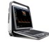 SonoScape - S9 Portable Color Doppler Ultrasound System