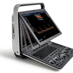 S8 Exp Portable Color Doppler Ultrasound Scanner