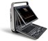 SonoScape - S8 Exp Portable Color Doppler Ultrasound Scanner