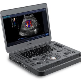X3 Portable Color Doppler Ultrasound System