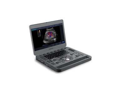 SonoScape - X3 Portable Color Doppler Ultrasound System