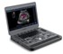 SonoScape - X3 Portable Color Doppler Ultrasound System