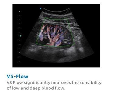 SIUI - Apogee 2100 Plus Digital Color Doppler Ultrasound Imaging System