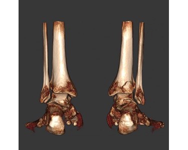 Curvebeam - CT Scanner | PedCAT 