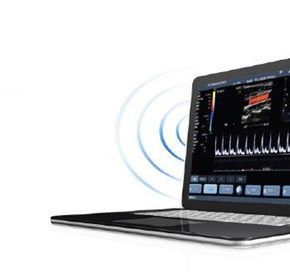 Handheld Point of Care Ultrasound