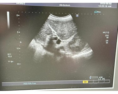 Toshiba - Xario Ultrasound | Ultrasound Machine | NEX335