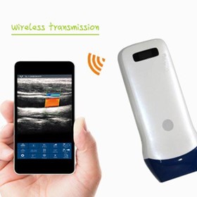 Wireless Ultrasound | Linear Series